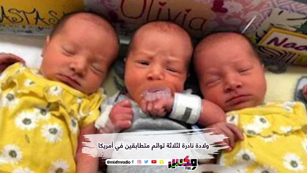 ولادة نادرة لثلاثة توائم متطابقين في أمريكا