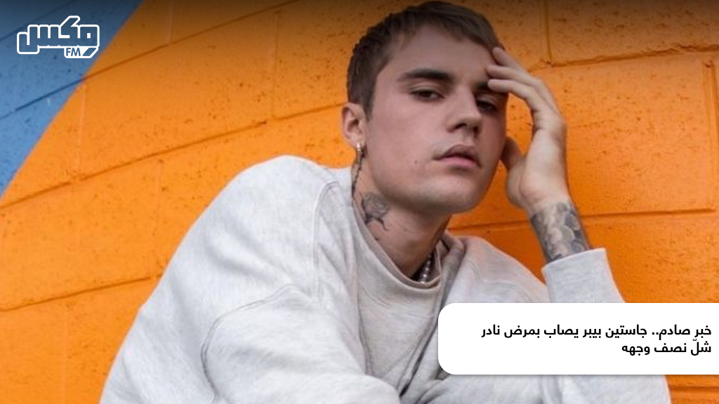 خبر صادم.. جاستين بيبر يصاب بمرض نادر شلّ نصف وجهه