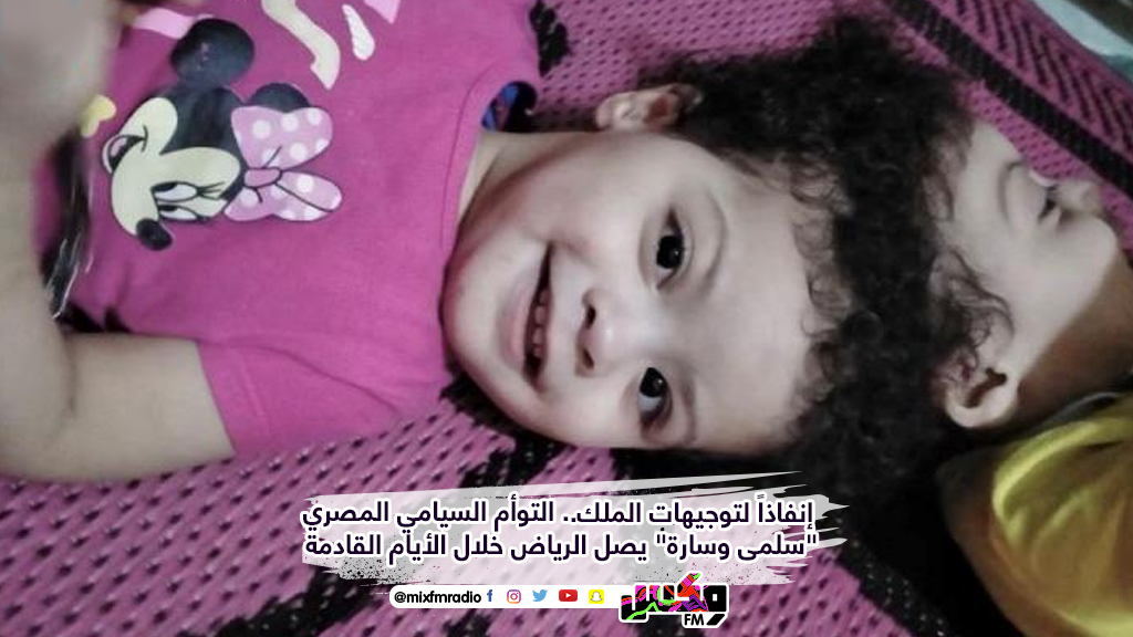 إنفاذاً لتوجيهات الملك.. التوأم السيامي المصري "سلمى وسارة"